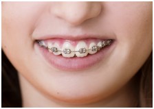 Fixné kovové strojčeky