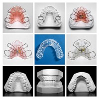 Detail keramických zámkov